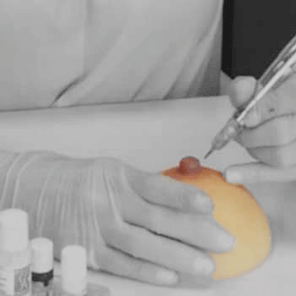 AREOLA PIGMENTATION Dubai Cosmetic Surgery Vilafortuny